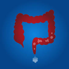 Incomplete Evacuation